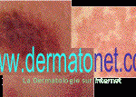 dermatonet.gif