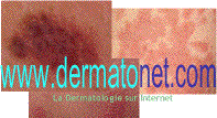 dermatonet.gif